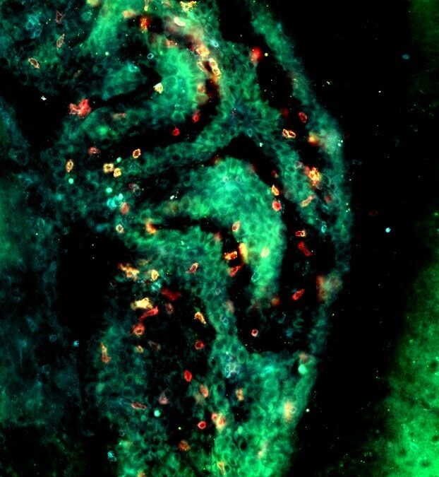 Toxoplasmose : identification d’un mécanisme assurant la surveillance immunitaire de l’infection dans le cerveau